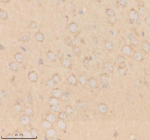 Immunohistochemical staining of SHD using anti-SHD antibody. SHD was detected in a paraffin-embedded section of mouse brain tissue. Heat mediated antigen retrieval was performed in EDTA buffer (pH 8.0, epitope retrieval solution). The tissue section was blocked with 10% goat serum. The tissue section was then incubated with 2 ug/ml rabbit anti-SHD antibody overnight at 4oC. Peroxidase Conjugated Goat Anti-rabbit IgG was used as secondary antibody and incubated for 30 minutes at 37oC. The tissue section was developed using an HRP secondary and DAB substrate.
