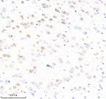 Immunohistochemical staining of ABCE1 using anti-ABCE1 antibody. ABCE1 was detected in a paraffin-embedded section of rat brain tissue. Heat mediated antigen retrieval was performed in EDTA buffer (pH 8.0, epitope retrieval solution). The tissue section was blocked with 10% goat serum. The tissue section was then incubated with 2 ug/ml rabbit anti-ABCE1 antibody overnight at 4oC. Peroxidase Conjugated Goat Anti-rabbit IgG was used as secondary antibody and incubated for 30 minutes at 37oC. The tissue section was developed using an HRP secondary and DAB substrate.