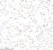 Immunohistochemical staining of ABCE1 using anti-ABCE1 antibody. ABCE1 was detected in a paraffin-embedded section of mouse brain tissue. Heat mediated antigen retrieval was performed in EDTA buffer (pH 8.0, epitope retrieval solution). The tissue section was blocked with 10% goat serum. The tissue section was then incubated with 2 ug/ml rabbit anti-ABCE1 antibody overnight at 4oC. Peroxidase Conjugated Goat Anti-rabbit IgG was used as secondary antibody and incubated for 30 minutes at 37oC. The tissue section was developed using an HRP secondary and DAB substrate.