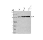 Western blot analysis of PYK2/PTK2B using anti-PTK2B antibody. Electrophoresis was performed on a 8% SDS-PAGE gel at 80V (Stacking gel) / 120V (Resolving gel) for 2 hours. Lane 1: human whole cell lysates, Lane 2: rat brain tissue lysates, Lane 3: mouse brain tissue lysates. After electrophoresis, proteins were transferred to a nitrocellulose membrane at 150 mA for 50-90 minutes. Blocked the membrane with 5% non-fat milk/TBS for 1.5 hour at RT. The membrane was incubated with rabbit anti-PTK2B antibody at 0.5 ug/ml overnight at 4oC, then washed with TBS-0.1%Tween 3 times with 5 minutes each and probed with a goat anti-rabbit IgG-HRP secondary antibody at a dilution of 1:5000 for 1.5 hour at RT. The signal was developed using an ECL Plus Western Blotting Substrate. A specific band was detected for PYK2/PTK2B at approximately 116 kDa. The expected molecular weight of PYK2/PTK2B is at 116 kDa.