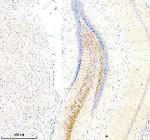 Immunohistochemical staining of SLC7A14 using anti-SLC7A14 antibody. SLC7A14 was detected in a paraffin-embedded section of rat brain tissue. Heat mediated antigen retrieval was performed in EDTA buffer (pH 8.0, epitope retrieval solution). The tissue section was blocked with 10% goat serum. The tissue section was then incubated with 2 ug/ml rabbit anti-SLC7A14 antibody overnight at 4oC. Peroxidase Conjugated Goat Anti-rabbit IgG was used as secondary antibody and incubated for 30 minutes at 37oC. The tissue section was developed using an HRP secondary and DAB substrate.