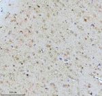 Immunohistochemical staining of Tuberin/TSC2 (Phospho-S939) using anti-Phospho-Tuberin (pSer939) antibody. Tuberin/TSC2 (Phospho-S939) was detected in a paraffin-embedded section of rat brain tissue. Heat mediated antigen retrieval was performed in EDTA buffer (pH 8.0, epitope retrieval solution). The tissue section was blocked with 10% goat serum. The tissue section was then incubated with a dilution of 1:50 rabbit anti-Phospho-Tuberin (Ser939) antibody overnight at 4oC. Peroxidase Conjugated Goat Anti-rabbit IgG was used as secondary antibody and incubated for 30 minutes at 37oC. The tissue section was developed using an HRP secondary and DAB substrate.