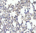 GPRC5A Antibody Rat Lung IHC. Immunohistochemistry analysis of FFPE rat lung tissue using GPRC5A Antibody. Heat induced antigen retrieval was performed in pH 8.0 EDTA buffer prior to overnight incubation with primary antibody (2 ug/mL) at 4Â°C. Peroxidase-conjugated goat anti-rabbit IgG and DAB chromogen were used for visualization. Predominantly membranous staining is observed in alveolar and bronchiolar epithelial cells, consistent with the localization of GPRC5A as a retinoic acid-inducible orphan G protein-coupled receptor expressed in pulmonary epithelium. These results support the use of GPRC5A Antibody / Retinoic Acid Inducible GPCR Antibody for studying GPRC5A expression, epithelial GPCR biology and lung homeostasis.