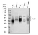 GPRC5A Antibody Human, Mouse and Rat WB. Western blot analysis using GPRC5A Antibody. Lane 1: human A375 cells; Lane 2: human MCF-7 cells; Lane 3: human HeLa cells; Lane 4: rat lung tissue; Lane 5: mouse lung tissue. Multiple immunoreactive bands are detected between approximately 37-50 kDa, consistent with the expected molecular weight of GPRC5A (~40 kDa) and the presence of different glycosylated or processed forms of this membrane-associated G protein-coupled receptor. Detection in human cell lines together with rat and mouse lung tissue supports cross-species reactivity. These results support the use of GPRC5A Antibody / Retinoic Acid Inducible GPCR Antibody for studying GPRC5A expression, epithelial GPCR biology and retinoic acid-regulated signaling.