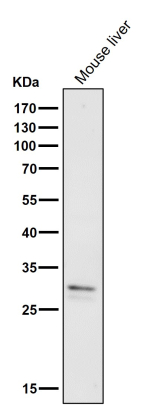 VAPA Antibody Mouse Liver WB. Western blot analysis of mouse liver tissue lysate using VAPA Antibody / Vesicle-Associated Membrane Protein-Associated Protein A demonstrates a distinct band at approximately 28-33 kDa, consistent with the predicted molecular weight of VAPA. VAPA is an endoplasmic reticulum-associated membrane protein that functions in intracellular trafficking, lipid transport, organelle organization, and membrane contact site formation. The observed band confirms expression of VAPA in mouse liver tissue and supports application of the antibody for Western blot detection of VAPA in murine samples. Antibody incubation was performed at a 1:1000 dilution for 1 hour at room temperature.
