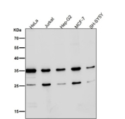 Western blot testing of human samples using the Phospho-Nucleophosmin (pSer125) antibody at 1:3000 dilution for 1 hour at room temperature. A predominant band is observed at ~35 kDa, consistent with phosphorylated NPM1 migrating slightly above its predicted 33 kDa. An additional ~26 kDa species is detected, consistent with a Ser125-containing proteolytic fragment of NPM1 that appears in some cell lysates.