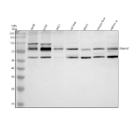 Western blot analysis of TRIM47 using anti-TRIM47 antibody. Electrophoresis was performed on a 10% SDS-PAGE gel at 80V (Stacking gel) / 120V (Resolving gel) for 2 hours. Lane 1: human whole cell lysates, Lane 2: human U251 whole cell lysates, Lane 3: human whole cell lysates, Lane 4: rat liver tissue lysates, Lane 5: rat RH35 whole cell lysates, Lane 6: mouse liver tissue lysates, Lane 7: mouse HEPA1-6 whole cell lysates. After electrophoresis, proteins were transferred to a nitrocellulose membrane at 150 mA for 50-90 minutes. Blocked the membrane with 5% non-fat milk/TBS for 1.5 hour at RT. The membrane was incubated with rabbit anti-TRIM47 antibody at 0.5 ug/ml overnight at 4oC, then washed with TBS-0.1%Tween 3 times with 5 minutes each and probed with a goat anti-rabbit IgG-HRP secondary antibody at a dilution of 1:5000 for 1.5 hour at RT. The signal was developed using an ECL Plus Western Blotting Substrate. A major band is observed just above 70 kDa, consistent with full-length TRIM47, and a consistent ~55 kDa band is present across samples. The lower species is consistent with a truncated/processed N-terminal form or shorter isoform of TRIM47, a behavior commonly reported for TRIM E3 ligases.