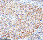 Immunohistochemical staining of ADAM12 using anti-ADAM12 antibody. ADAM12 was detected in a paraffin-embedded section of rat ovary tissue. Heat mediated antigen retrieval was performed in EDTA buffer (pH 8.0, epitope retrieval solution). The tissue section was blocked with 10% goat serum. The tissue section was then incubated with 1:100 rabbit anti-ADAM12 antibody overnight at 4oC. Peroxidase Conjugated Goat Anti-rabbit IgG was used as secondary antibody and incubated for 30 minutes at 37oC. The tissue section was developed using an HRP secondary and DAB substrate.