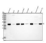 Western blot analysis of RIG using anti-RIG antibody. Lane 1: human SH-SY5Y whole cell lysates, Lane 2: human U251 whole cell lysates, Lane 3: human U20S whole cell lysates, Lane 4: human U-87MG whole cell lysates, Lane 5: rat brain tissue lysates, Lane 6: rat C6 whole cell lysates, Lane 7: mouse brain tissue lysates, Lane 8: mouse Neuro-2a whole cell lysates. After electrophoresis, proteins were transferred to a nitrocellulose membrane at 150 mA for 50-90 minutes. Blocked the membrane with 5% non-fat milk/TBS for 1.5 hour at RT. The membrane was incubated with rabbit anti-DKK3 antibody at 0.5 ug/ml overnight at 4oC, then washed with TBS-0.1%Tween 3 times with 5 minutes each and probed with a goat anti-rabbit IgG-HRP secondary antibody at a dilution of 1:5000 for 1.5 hour at RT. The signal was developed using enhanced chemiluminescent. Western blot analysis of putative protein RIG using anti-RIG antibody. A single band is detected at ~22 kDa in multiple lysates, running above the ~12 kDa prediction. The higher apparent MW is consistent with the known anomalous SDS-PAGE migration of this small hydrophobic protein and its partial oligomer/membrane association; it is distinct from RIG-I (DDX58).