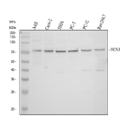 MX1 Antibody Human Mouse Rat WB. Western blot analysis of human whole cell lysate (lane 1), human Caco-2 cells (lane 2), human SiHa cells (lane 3), human PC-3 cells (lane 4), rat PC-12 cells (lane 5), and mouse RAW264.7 cells (lane 6) using MX1 Antibody / Antiviral Response Protein Antibody demonstrates a prominent band at approximately 76 kDa, consistent with the expected molecular weight of MX1. Also known as Myxovirus Resistance Protein 1 (MxA), MX1 is an interferon-inducible dynamin-like GTPase that functions as a key mediator of innate antiviral immunity. MX1 is activated downstream of interferon signaling pathways and contributes to host defense by restricting viral replication and supporting antiviral response mechanisms. Detection of a consistent ~76 kDa band across human, rat, and mouse cell lysates supports the utility of this antibody for cross-species western blot analysis of MX1 expression. Electrophoresis was performed on a 10% SDS-PAGE gel followed by nitrocellulose transfer and HRP-ECL detection.