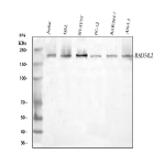 Western blot analysis of RAD54L2 using anti-RAD54L2 antibody. Lane 1: human Jurkat whole cell lysates, Lane 2: human HEL whole cell lysates, Lane 3: human SH-SY5Y whole cell lysates, Lane 4: rat PC-12 whole cell lysates, Lane 5: mouse Raw264.7 whole cell lysates, Lane 6: mouse Ana-1 whole cell lysates. After electrophoresis, proteins were transferred to a nitrocellulose membrane at 150 mA for 50-90 minutes. Blocked the membrane with 5% non-fat milk/TBS for 1.5 hour at RT. The membrane was incubated with rabbit anti-RAD54L2 antibody at 0.5 ug/ml overnight at 4oC, then washed with TBS-0.1%Tween 3 times with 5 minutes each and probed with a goat anti-rabbit IgG-HRP secondary antibody at a dilution of 1:5000 for 1.5 hour at RT. The signal was developed using enhanced chemiluminescent. A single prominent band is detected at ~190-200 kDa, higher than the predicted molecular weight of 163 kDa. This apparent shift is consistent with published observations for RAD54L2 and is attributed to its coiled-coil structure and post-translational modifications, including phosphorylation and sumoylation, which collectively cause slower migration on SDS-PAGE.