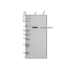 Western blot analysis of Matrilin-4/MATN4 using anti-MATN4 antibody. Electrophoresis was performed on a 10% SDS-PAGE gel at 80V (Stacking gel) / 120V (Resolving gel) for 2 hours. Lane 1: human Hela whole cell lysates, Lane 2: human Jurkat whole cell lysates. After electrophoresis, proteins were transferred to a nitrocellulose membrane at 150 mA for 50-90 minutes. Blocked the membrane with 5% non-fat milk/TBS for 1.5 hour at RT. The membrane was incubated with rabbit anti-MATN4 antibody at 0.5 ug/ml overnight at 4oC, then washed with TBS-0.1%Tween 3 times with 5 minutes each and probed with a goat anti-rabbit IgG-HRP secondary antibody at a dilution of 1:5000 for 1.5 hour at RT. The signal was developed using an ECL Plus Western Blotting Substrate. A specific band was detected for Matrilin-4/MATN4 at approximately 68 kDa. The expected molecular weight of Matrilin-4/MATN4 is at 68 kDa.