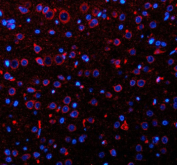 Immunofluorescent staining of OPN3 using anti-OPN3 antibody. OPN3 was detected in a paraffin-embedded section of rat brain tissue. Heat mediated antigen retrieval was performed in EDTA buffer (pH 8.0, epitope retrieval solution). The tissue section was blocked with 10% goat serum. The tissue section was then incubated with 5 ug/ml rabbit anti-OPN3 antibody overnight at 4oC. Cy3 Conjugated Goat Anti-Rabbit IgG was used as secondary antibody at 1:500 dilution and incubated for 30 minutes at 37oC. The section was counterstained with DAPI nuclear stain (blue). Visualize using a fluorescence microscope and filter sets appropriate for the label used.