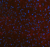 NEFM Antibody Mouse Brain IF. Immunofluorescent staining of FFPE mouse brain tissue using NEFM Antibody. Heat-induced epitope retrieval was performed in pH 8.0 EDTA buffer prior to incubation with the primary antibody at 5 ug/mL overnight at 4Â°C. A Cy3-conjugated goat anti-rabbit secondary antibody (red) was used for detection, and nuclei were counterstained with DAPI (blue). Bright red fluorescence highlights neuronal cell bodies and an extensive network of neuronal processes throughout the brain tissue, consistent with the expected distribution of neurofilament medium chain within the neuronal cytoskeleton. These results demonstrate that NEFM Antibody, a Neuronal Cytoskeletal Marker Antibody, specifically detects endogenous neurofilament medium chain in FFPE mouse brain tissue.