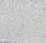 NEFM Antibody Rat Brain IHC. Immunohistochemical staining of FFPE rat brain tissue using NEFM Antibody. Heat-induced epitope retrieval was performed in pH 8.0 EDTA buffer prior to incubation with the primary antibody at 2 ug/mL overnight at 4Â°C. An HRP-conjugated goat anti-rabbit secondary antibody with DAB chromogen was used for visualization. Widespread cytoplasmic staining is observed in neurons throughout the brain, with prominent labeling of neuronal cell bodies and processes, consistent with the expected distribution of neurofilament medium chain within the neuronal cytoskeleton. These results demonstrate that NEFM Antibody, a Neuronal Cytoskeletal Marker Antibody, specifically detects endogenous neurofilament medium chain in FFPE rat brain tissue.