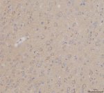GALC Antibody Mouse Brain IHC. Immunohistochemical staining of FFPE mouse brain tissue using GALC antibody at 2 ug/ml following heat-induced epitope retrieval in pH8 EDTA buffer. Detection was performed using an HRP-conjugated secondary antibody with DAB chromogen. GALC immunoreactivity is observed throughout the brain parenchyma with predominantly cytoplasmic staining in neural cells, consistent with the lysosomal localization of Galactocerebrosidase, an essential enzyme involved in galactolipid metabolism and myelin maintenance. This result demonstrates that the GALC Antibody / Galactocerebrosidase Antibody is suitable for immunohistochemical detection of endogenous GALC in formalin-fixed, paraffin-embedded mouse tissue.