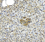EIF2A Antibody Pancreas IHC. Immunohistochemistry analysis of FFPE human pancreas tissue stained with EIF2A antibody detecting Eukaryotic initiation factor 2A. Cytoplasmic staining is observed in pancreatic cells with moderate intensity and a granular distribution, consistent with EIF2A localization in ribosome-associated translation machinery and involvement in non-canonical protein synthesis. The staining highlights both exocrine and endocrine cellular compartments, with nuclei counterstained blue. HIER: heat-mediated antigen retrieval in pH 8 EDTA buffer.