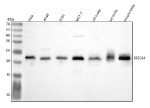 Western blot analysis of SSSCA1/ZNRD2 using anti-ZNRD2 antibody. Lane 1: human Hela whole cell lysates, Lane 2: human whole cell lysates, Lane 3: human 293T whole cell lysates, Lane 4: human MCF-7 whole cell lysates, Lane 5: rat ovary tissue lysates, Lane 6: rat testis tissue lysates, Lane 7: mouse testis tissue lysates. After electrophoresis, proteins were transferred to a nitrocellulose membrane at 150 mA for 50-90 minutes. Blocked the membrane with 5% non-fat milk/TBS for 1.5 hour at RT. The membrane was incubated with rabbit anti-ZNRD2 antibody at 0.5 ug/ml overnight at 4oC, then washed with TBS-0.1%Tween 3 times with 5 minutes each and probed with a goat anti-rabbit IgG-HRP secondary antibody at a dilution of 1:5000 for 1.5 hour at RT. The signal was developed using enhanced chemiluminescent. The expected molecular weight of SSSCA1/ZNRD2 is at 21 kDa.