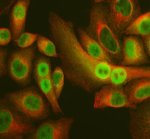 STAM2 Antibody A549 Cell IF. Immunofluorescent staining of fixed and permeabilized A549 cells with STAM2 Antibody / Signal Transducing Adaptor Molecule 2 Antibody (green) and an Alpha Tubulin antibody (red). Cells underwent enzyme antigen retrieval for 15 minutes, were blocked with 10% goat serum, and incubated overnight at 4 degrees C with rabbit anti-STAM2 antibody at 5 ug/ml and mouse anti-Alpha Tubulin antibody. Fluoro488- and Cy3-conjugated secondary antibodies were used at a 1:500 dilution. STAM2 exhibits predominantly cytoplasmic staining with a fine punctate distribution, consistent with its localization to endosomal compartments. This STAM2 Antibody, also called Signal Transducing Adaptor Molecule 2 Antibody, is suitable for studies of endosomal trafficking and intracellular vesicle dynamics.