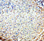 P4HA1 Antibody Human Liver IHC. Immunohistochemistry was performed on FFPE human liver tissue using P4HA1 Antibody. Heat-induced epitope retrieval was carried out in pH 8 EDTA buffer prior to incubation with the primary antibody at 2 ug/ml. Bound antibody was detected using an HRP-conjugated goat anti-rabbit IgG secondary antibody with DAB chromogen. Moderate diffuse cytoplasmic staining is observed in hepatocytes, consistent with the constitutive expression of P4HA1 as an essential enzyme involved in collagen biosynthesis and extracellular matrix homeostasis. These results demonstrate that this Collagen Biosynthesis Enzyme Antibody is suitable for immunohistochemical detection of P4HA1 in formalin-fixed, paraffin-embedded human liver tissue.