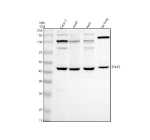 Western blot analysis of TNIP3 using anti-TNIP3 antibody. Electrophoresis was performed on a 10% SDS-PAGE gel at 80V (Stacking gel) / 120V (Resolving gel) for 2 hours. Lane 1: human Caco-2 whole cell lysates, Lane 2: human whole cell lysates, Lane 3: human Hela whole cell lysates, Lane 4: rat lung tissue lysates. After electrophoresis, proteins were transferred to a nitrocellulose membrane at 150 mA for 50-90 minutes. Blocked the membrane with 5% non-fat milk/TBS for 1.5 hour at RT. The membrane was incubated with rabbit anti-TNIP3 antibody at 0.5 ug/ml overnight at 4oC, then washed with TBS-0.1%Tween 3 times with 5 minutes each and probed with a goat anti-rabbit IgG-HRP secondary antibody at a dilution of 1:5000 for 1.5 hour at RT. The signal was developed using an ECL Plus Western Blotting Substrate. TNIP3 antibody detects a predominant band at ~43-45 kDa across the indicated samples. Although the theoretical mass is ~39 kDa, TNIP3 typically migrates slower due to phosphorylation and sequence composition. Additional bands at ~80 kDa, ~100 kDa, and ~150 kDa in human samples, and ~120-130 kDa in rat lung, likely represent ubiquitinated or oligomeric TNIP3 species.