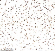 Immunohistochemical staining of Histone H3 (acetyl K9) using anti-Histone H3 (acetyl K9) antibody. Histone H3 (acetyl K9) was detected in a paraffin-embedded section of mouse brain tissue. Heat mediated antigen retrieval was performed in EDTA buffer (pH 8.0, epitope retrieval solution). The tissue section was blocked with 10% goat serum. The tissue section was then incubated with 1:50 rabbit anti-Histone H3 (acetyl K9) antibody overnight at 4oC. Peroxidase Conjugated Goat Anti-rabbit IgG was used as secondary antibody and incubated for 30 minutes at 37oC. The tissue section was developed using an HRP secondary and DAB substrate.