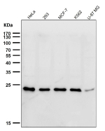 Western blot testing of human samples using the UBE2T antibody at 1:1000 dilution for 1 hour at room temperature. Predicted molecular weight ~22 kDa.