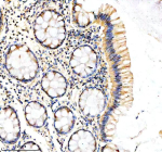 Immunohistochemical staining of DKC1 using anti-DKC1 antibody. DKC1 was detected in a paraffin-embedded section of human colon tissue. Heat mediated antigen retrieval was performed in EDTA buffer (pH 8.0, epitope retrieval solution). The tissue section was blocked with 10% goat serum. The tissue section was then incubated with 2 ug/ml rabbit anti-DKC1 antibody overnight at 4oC. Peroxidase Conjugated Goat Anti-rabbit IgG was used as secondary antibody and incubated for 30 minutes at 37oC. The tissue section was developed using an HRP secondary and DAB substrate.