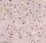 Immunohistochemical staining of EVC2 using anti-EVC2 antibody. EVC2 was detected in a paraffin-embedded section of rat midbrain tissue. Heat mediated antigen retrieval was performed in EDTA buffer (pH 8.0, epitope retrieval solution). The tissue section was blocked with 10% goat serum. The tissue section was then incubated with 2 ug/ml rabbit anti-EVC2 antibody overnight at 4oC. Peroxidase Conjugated Goat Anti-rabbit IgG was used as secondary antibody and incubated for 30 minutes at 37oC. The tissue section was developed using an HRP secondary and DAB substrate.