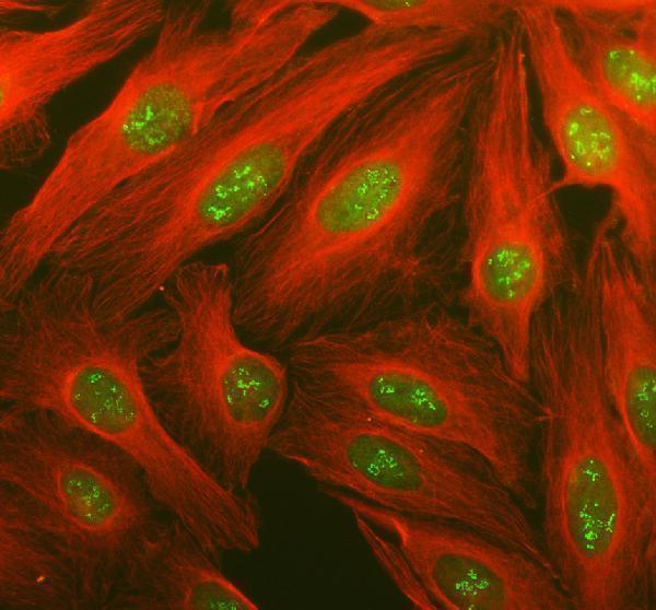 PBRM1 Antibody / PBAF Chromatin Remodeling Protein Antibody U2OS Cell IF. Immunofluorescent staining of U2OS cells using PBRM1 Antibody / PBAF Chromatin Remodeling Protein Antibody. PBRM1 is detected predominantly within the nuclei (green), consistent with its role as a subunit of the PBAF SWI/SNF chromatin remodeling complex involved in transcriptional regulation, chromatin organization, and tumor suppression. Alpha Tubulin (red) was used as a cytoskeletal marker. Enzymatic antigen retrieval was performed for 15 minutes prior to staining. Cells were blocked with 10% goat serum and incubated overnight at 4Â°C with rabbit anti-PBRM1 antibody (5 ug/ml) and mouse anti-Alpha Tubulin antibody, followed by Fluoro488-conjugated goat anti-rabbit IgG and Cy3-conjugated goat anti-mouse IgG secondary antibodies. Fluorescence was visualized using appropriate filter sets.