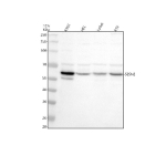 Western blot analysis of SESN2 using anti-SESN2 antibody. Electrophoresis was performed on a 10% SDS-PAGE gel at 80V (Stacking gel) / 120V (Resolving gel) for 2 hours. Lane 1: human K562 whole cell lysates, Lane 2: human HEL whole cell lysates, Lane 3: human Jurkat whole cell lysates, Lane 4: human RT4 whole cell lysates. After electrophoresis, proteins were transferred to a nitrocellulose membrane at 150 mA for 50-90 minutes. Blocked the membrane with 5% non-fat milk/TBS for 1.5 hour at RT. The membrane was incubated with rabbit anti-SESN2 antibody at 0.5 ug/ml overnight at 4oC, then washed with TBS-0.1%Tween 3 times with 5 minutes each and probed with a goat anti-rabbit IgG-HRP secondary antibody at a dilution of 1:5000 for 1.5 hour at RT. The signal was developed using an ECL Plus Western Blotting Substrate. Western blot detection of SESN2 shows a predominant band at ~60 kDa with minor species at ~50 kDa and ~70 kDa. Although the calculated mass is ~54-55 kDa, SESN2 commonly migrates slightly larger on SDS-PAGE, and the additional bands likely reflect truncated and post-translationally modified forms.