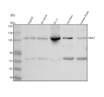 Western blot analysis of GBA2 using anti-GBA2 antibody. Lane 1: human HepG2 whole cell lysates, Lane 2: human SH-SY5Y whole cell lysates, Lane 3: human PC-3 whole cell lysates, Lane 4: rat brain tissue lysates, Lane 5: mouse brain tissue lysates. After electrophoresis, proteins were transferred to a nitrocellulose membrane at 150 mA for 50-90 minutes. Blocked the membrane with 5% non-fat milk/TBS for 1.5 hour at RT. The membrane was incubated with rabbit anti-GBA2 antibody at 0.5 ug/ml overnight at 4oC, then washed with TBS-0.1%Tween 3 times with 5 minutes each and probed with a goat anti-rabbit IgG-HRP secondary antibody at a dilution of 1:5000 for 1.5 hour at RT. The signal was developed using enhanced chemiluminescent. Western blot detection of GBA2 shows the expected ~105 kDa full-length band and an additional ~55 kDa species, consistent with reported C-terminal proteolytic fragments of GBA2 observed in various cell types and tissues.
