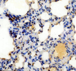 Immunohistochemical staining of SRA1 using anti-SRA1 antibody. SRA1 was detected in a paraffin-embedded section of rat lung tissue. Heat mediated antigen retrieval was performed in EDTA buffer (pH 8.0, epitope retrieval solution). The tissue section was blocked with 10% goat serum. The tissue section was then incubated with 1: 200 rabbit anti-SRA1 antibody overnight at 4oC. Peroxidase Conjugated Goat Anti-rabbit IgG was used as secondary antibody and incubated for 30 minutes at 37oC. The tissue section was developed using an HRP secondary and DAB substrate.