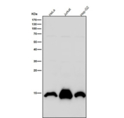 Histone H2A (mono methyl K118) Antibody / HIST1H2A Nucleosome Stability Antibody (clone 31H85) for WB. Western blot analysis of HIST1H2A / Histone H2A Lys118 monomethylation (H2AK118me1) in human cell lysates including HeLa, Jurkat, and HepG2 using Histone H2A (mono methyl K118) Antibody / HIST1H2A Nucleosome Stability Antibody. A band is detected at the predicted molecular weight of approximately 14 kDa corresponding to monomethylated Histone H2A, consistent with nucleosome-associated chromatin and structural regulation of chromatin stability.