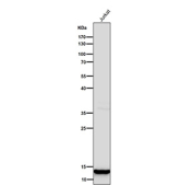 Histone H4 (mono methyl K20) Antibody WB. Western blot analysis of HIST1H4 / Histone H4 lysine 20 monomethylation (H4K20me1) in human Jurkat cell lysate using Histone H4 (mono methyl K20) Antibody / HIST1H4 Chromatin Compaction Regulation Antibody. A band is detected at the predicted molecular weight corresponding to monomethylated Histone H4, consistent with nuclear chromatin-associated localization and its role in chromatin compaction and cell cycle-regulated genome stability.