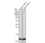 Histone H4 (mono methyl K20) Antibody Mouse Tissue WB. Western blot analysis of HIST1H4 / Histone H4 lysine 20 monomethylation (H4K20me1) in mouse spleen and mouse kidney tissue lysates using Histone H4 (mono methyl K20) Antibody / HIST1H4 Chromatin Compaction Regulation Antibody. A band is detected at the predicted molecular weight corresponding to monomethylated Histone H4, consistent with nuclear chromatin-associated localization and its role in chromatin compaction and genome stability across tissues.