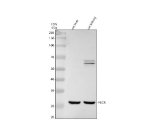 Western blot analysis of PECR using anti-PECR antibody. Electrophoresis was performed on a 10% SDS-PAGE gel at 80V (Stacking gel) / 120V (Resolving gel) for 2 hours. Lane 1: rat liver tissue lysates, Lane 2: rat kidney tissue lysates. After electrophoresis, proteins were transferred to a nitrocellulose membrane at 150 mA for 50-90 minutes. Blocked the membrane with 5% non-fat milk/TBS for 1.5 hour at RT. The membrane was incubated with rabbit anti-PECR antibody at 0.5 ug/ml overnight at 4oC, then washed with TBS-0.1%Tween 3 times with 5 minutes each and probed with a goat anti-rabbit IgG-HRP secondary antibody at a dilution of 1:5000 for 1.5 hour at RT. The signal was developed using an ECL Plus Western Blotting Substrate. A dominant band is detected between an approximately 28 and 30 kDa in both tissues, running slightly below the predicted ~33 kDa mass. This is consistent with the processed mature form of the peroxisomal enzyme PECR, which is expected to migrate a few kilodaltons lower than the 32-33 kDa precursor in vivo.