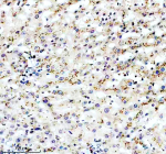 Immunohistochemical staining of PECR using anti-PECR antibody. PECR was detected in a paraffin-embedded section of human liver tissue. Heat mediated antigen retrieval was performed in EDTA buffer (pH 8.0, epitope retrieval solution). The tissue section was blocked with 10% goat serum. The tissue section was then incubated with 2 ug/ml rabbit anti-PECR antibody overnight at 4oC. Peroxidase Conjugated Goat Anti-rabbit IgG was used as secondary antibody and incubated for 30 minutes at 37oC. The tissue section was developed using an HRP secondary and DAB substrate.