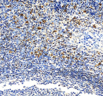 Immunohistochemical staining of ALOX5AP using anti-ALOX5AP antibody. ALOX5AP was detected in a paraffin-embedded section of human tonsil tissue. Heat mediated antigen retrieval was performed in EDTA buffer (pH 8.0, epitope retrieval solution). The tissue section was blocked with 10% goat serum. The tissue section was then incubated with 2 ug/ml rabbit anti-ALOX5AP antibody overnight at 4oC. Peroxidase Conjugated Goat Anti-rabbit IgG was used as secondary antibody and incubated for 30 minutes at 37oC. The tissue section was developed using an HRP secondary and DAB substrate.