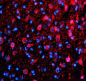 Immunofluorescent staining of TDP1 using anti-TDP1 antibody (red). TDP1 was detected in a paraffin-embedded section of rat brain tissue. Heat mediated antigen retrieval was performed in EDTA buffer (pH 8.0, epitope retrieval solution). The tissue section was blocked with 10% goat serum. The tissue section was then incubated with 5 ug/ml rabbit anti-TDP1 antibody overnight at 4oC. Cy3 Conjugated Goat Anti-Rabbit IgG was used as secondary antibody at 1:500 dilution and incubated for 30 minutes at 37oC. The section was counterstained with DAPI nuclear stain (blue). Visualize using a fluorescence microscope and filter sets appropriate for the label used.