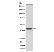 Western blot analysis of extracts from human HeLa cells, using Phospho-PKA C (pThr197) antibody. The predicted molecular weight of P-PRKA/C/G is ~40 kDa.