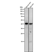 Western blot testing of mouse and rat skin tissue lysate using the Phospho-PKA C (pThr197) antibody at 1:1000 dilution for 1 hour at room temperature. The predicted molecular weight of P-PRKA/C/G is ~40 kDa.