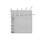 Western blot analysis of TAOK2 using anti-TAOK2 antibody. Electrophoresis was performed on a 8% SDS-PAGE gel at 80V (Stacking gel) / 120V (Resolving gel) for 2 hours. Lane 1: human 293T whole cell lysates, Lane 2: human MCF-7 whole cell lysates, Lane 3: rat brain tissue lysates, Lane 4: mouse brain tissue lysates. After electrophoresis, proteins were transferred to a nitrocellulose membrane at 150 mA for 50-90 minutes. Blocked the membrane with 5% non-fat milk/TBS for 1.5 hour at RT. The membrane was incubated with rabbit anti-TAOK2 antibody at 0.5 ug/ml overnight at 4oC, then washed with TBS-0.1%Tween 3 times with 5 minutes each and probed with a goat anti-rabbit IgG-HRP secondary antibody at a dilution of 1:5000 for 1.5 hour at RT. The signal was developed using an ECL Plus Western Blotting Substrate. The expected molecular weight of TAOK2 is ~138 kDa.