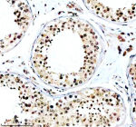 Immunohistochemical staining of TAOK2 using anti-TAOK2 antibody. TAOK2 was detected in a paraffin-embedded section of human testis tissue. Heat mediated antigen retrieval was performed in EDTA buffer (pH 8.0, epitope retrieval solution). The tissue section was blocked with 10% goat serum. The tissue section was then incubated with 2 ug/ml rabbit anti-TAOK2 antibody overnight at 4oC. Peroxidase Conjugated Goat Anti-rabbit IgG was used as secondary antibody and incubated for 30 minutes at 37oC. The tissue section was developed using an HRP secondary and DAB substrate.