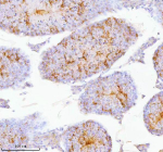 Immunohistochemical staining of SPA17 using anti-SPA17 antibody. SPA17 was detected in a paraffin-embedded section of mouse testis tissue. Heat mediated antigen retrieval was performed in EDTA buffer (pH 8.0, epitope retrieval solution). The tissue section was blocked with 10% goat serum. The tissue section was then incubated with 2 ug/ml rabbit anti-SPA17 antibody overnight at 4oC. Peroxidase Conjugated Goat Anti-rabbit IgG was used as secondary antibody and incubated for 30 minutes at 37oC. The tissue section was developed using an HRP secondary and DAB substrate.
