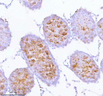 Immunohistochemical staining of SPA17 using anti-SPA17 antibody. SPA17 was detected in a paraffin-embedded section of rat testis tissue. Heat mediated antigen retrieval was performed in EDTA buffer (pH 8.0, epitope retrieval solution). The tissue section was blocked with 10% goat serum. The tissue section was then incubated with 2 ug/ml rabbit anti-SPA17 antibody overnight at 4oC. Peroxidase Conjugated Goat Anti-rabbit IgG was used as secondary antibody and incubated for 30 minutes at 37oC. The tissue section was developed using an HRP secondary and DAB substrate.