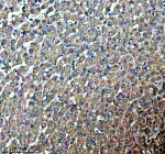 Immunohistochemical staining of PDZD8 using anti-PDZD8 antibody. PDZD8 was detected in a paraffin-embedded section of human liver tissue. Heat mediated antigen retrieval was performed in EDTA buffer (pH 8.0, epitope retrieval solution). The tissue section was blocked with 10% goat serum. The tissue section was then incubated with 2 ug/ml rabbit anti-PDZD8 antibody overnight at 4oC. Peroxidase Conjugated Goat Anti-rabbit IgG was used as secondary antibody and incubated for 30 minutes at 37oC. The tissue section was developed using an HRP secondary and DAB substrate.