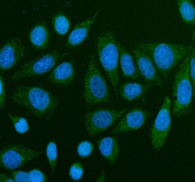 TMEM232 Antibody Human SiHa Cells IF. Immunofluorescent staining of TMEM232 using anti-TMEM232 antibody (green). TMEM232 was detected in an immunocytochemical section of human SiHa cells. Enzyme antigen retrieval was performed using IHC enzyme antigen retrieval reagent for 15 mins. The cells were blocked with 10% goat serum. And then incubated with 5 ug/ml rabbit anti-TMEM232 antibody overnight at 4oC. DyLight 488 Conjugated Goat Anti-Rabbit IgG was used as secondary antibody at 1:500 dilution and incubated for 30 minutes at 37oC. The section was counterstained with DAPI nuclear stain (blue). Visualize using a fluorescence microscope and filter sets appropriate for the label used.