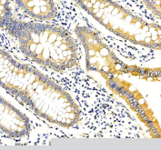 TMEM232 Antibody Human Colon Tissue IHC. Immunohistochemical staining of TMEM232 using anti-TMEM232 antibody. TMEM232 was detected in a paraffin-embedded section of human colon tissue. Heat mediated antigen retrieval was performed in EDTA buffer (pH 8.0, epitope retrieval solution). The tissue section was blocked with 10% goat serum. The tissue section was then incubated with 2 ug/ml rabbit anti-TMEM232 antibody overnight at 4oC. Peroxidase Conjugated Goat Anti-rabbit IgG was used as secondary antibody and incubated for 30 minutes at 37oC. The tissue section was developed using an HRP secondary and DAB substrate.
