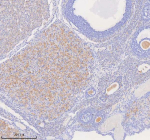 Immunohistochemical staining of COQ8B using anti-COQ8B antibody. COQ8B was detected in a paraffin-embedded section of rat ovary tissue. Heat mediated antigen retrieval was performed in EDTA buffer (pH 8.0, epitope retrieval solution). The tissue section was blocked with 10% goat serum. The tissue section was then incubated with 2 ug/ml rabbit anti-COQ8B antibody overnight at 4oC. Peroxidase Conjugated Goat Anti-rabbit IgG was used as secondary antibody and incubated for 30 minutes at 37oC. The tissue section was developed using an HRP secondary and DAB substrate.